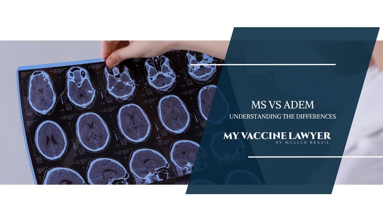 ADEM vs MS: Understanding the Differences and Diagnoses