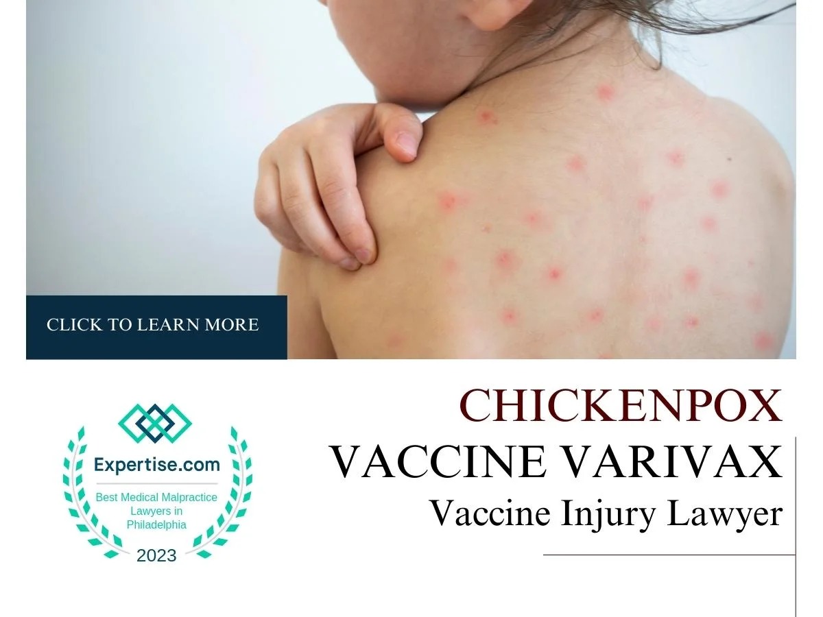 Varivax Vaccine: Everything you need to know about the Chickenpox vaccine